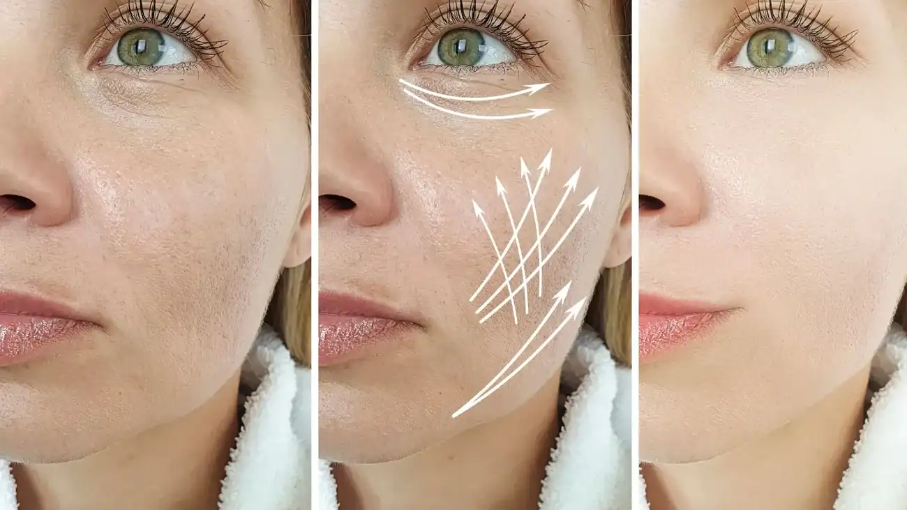 Can One Treatment Really Tackle More Than One Skin Concern Bletchley?