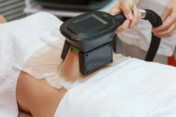 Image of person having fat freezing treatment to help weight gain Bletchley