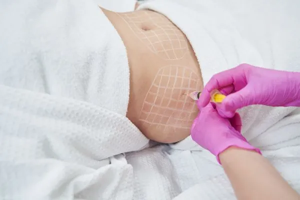 image of fat dissolving injections on love handles to help combat weight gain Bletchley