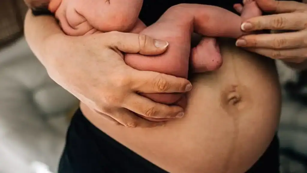 Why Is My Stomach Still Big After Pregnancy Bletchley?